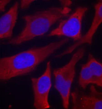 Immunocytochemistry/ Immunofluorescence - Anti-Synapsin I (phospho S9) antibody (AB194778)