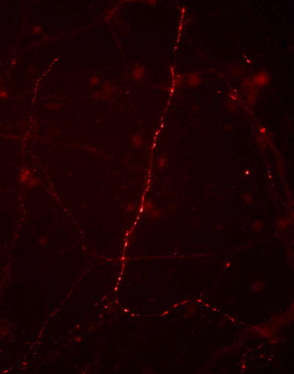 Immunocytochemistry/ Immunofluorescence - Anti-Synapsin I (phospho S9) antibody (AB254033), expandable thumbnail