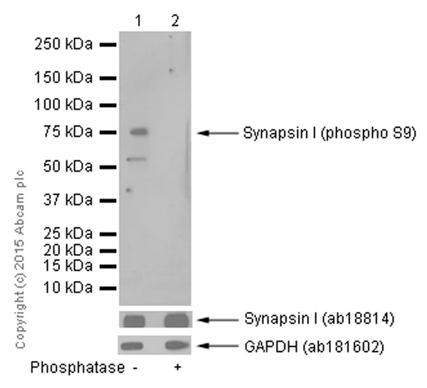 Western blot - Anti-Synapsin I (phospho S9) antibody [EP2162Y] - BSA and Azide free (AB247457)