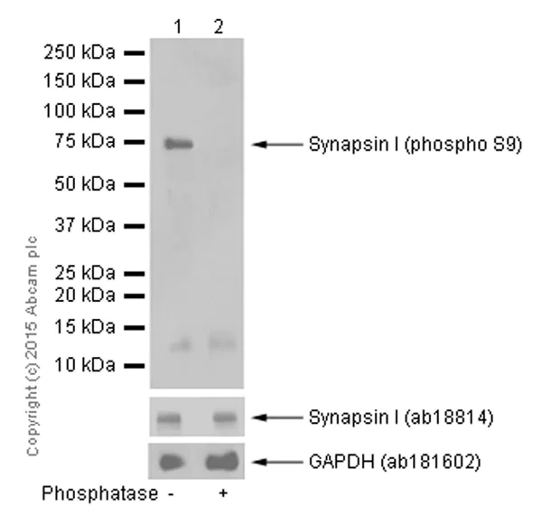 Western blot - Anti-Synapsin I (phospho S9) antibody [EP2162Y] - BSA and Azide free (AB247457)