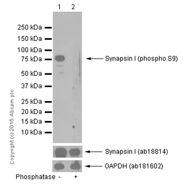 Western blot - Anti-Synapsin I (phospho S9) antibody [EP2162Y] - BSA and Azide free (AB247457)