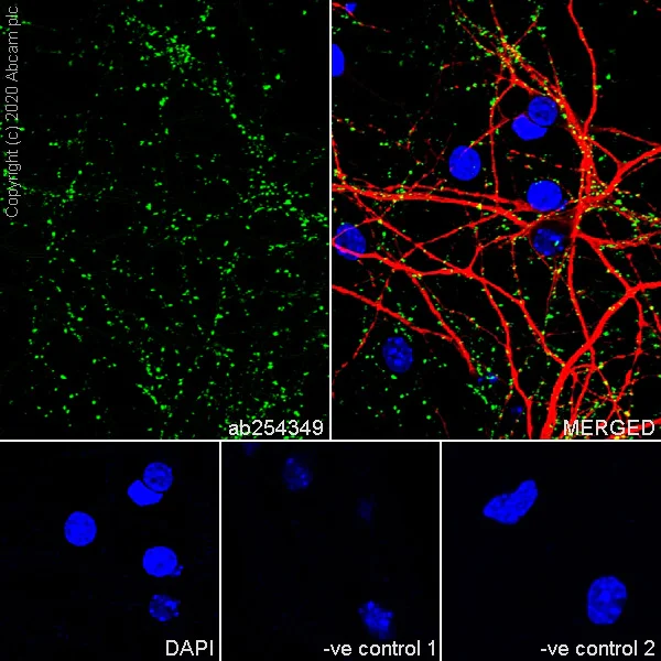 Immunocytochemistry/ Immunofluorescence - Synaptic Marker (Synaptophysin, Synapsin1, PSD95, VAMP2) Antibody Sampler Panel - Human, Mouse (AB263463)