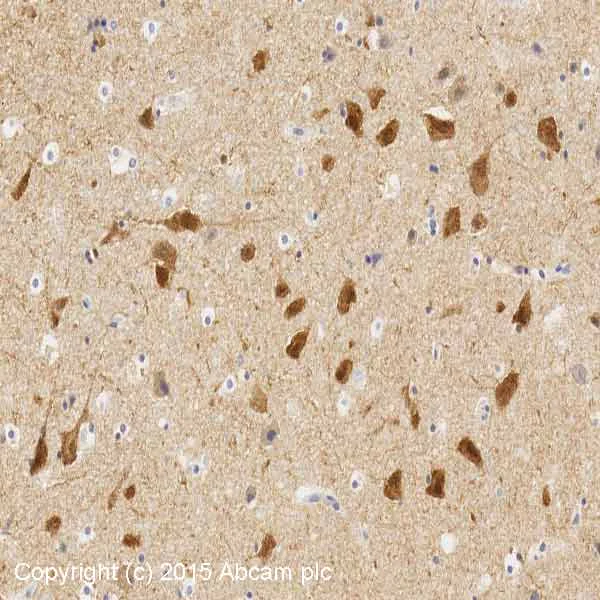 Immunohistochemistry (Formalin/PFA-fixed paraffin-embedded sections) - Synaptic Marker (Synaptophysin, Synapsin1, PSD95, VAMP2) Antibody Sampler Panel - Human, Mouse (AB263463)