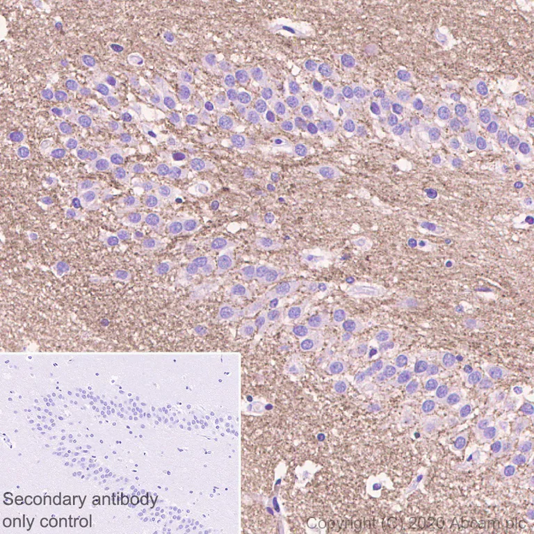 Immunohistochemistry (Formalin/PFA-fixed paraffin-embedded sections) - Synaptic Marker (Synaptophysin, Synapsin1, PSD95, VAMP2) Antibody Sampler Panel - Human, Mouse (AB263463)