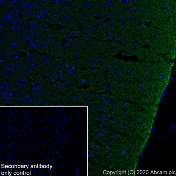 Immunohistochemistry (Frozen sections) - Synaptic Marker (Synaptophysin, Synapsin1, PSD95, VAMP2) Antibody Sampler Panel - Human, Mouse (ab263463), expandable thumbnail