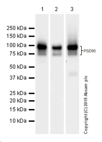 Western blot - Synaptic Marker (Synaptophysin, Synapsin1, PSD95, VAMP2) Antibody Sampler Panel - Human, Mouse (ab263463), expandable thumbnail