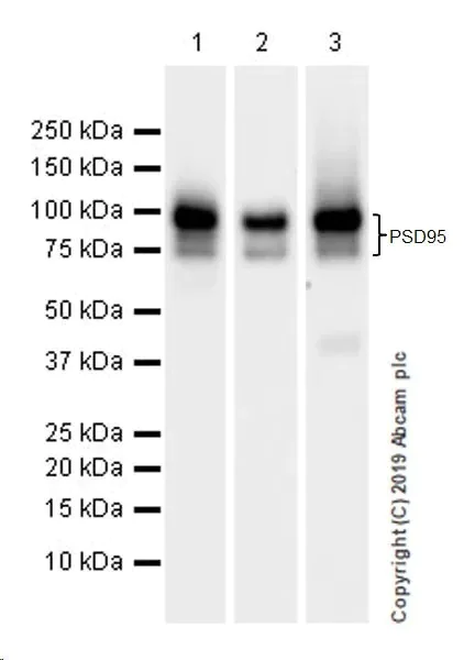 Western blot - Synaptic Marker (Synaptophysin, Synapsin1, PSD95, VAMP2) Antibody Sampler Panel - Human, Mouse (AB263463)
