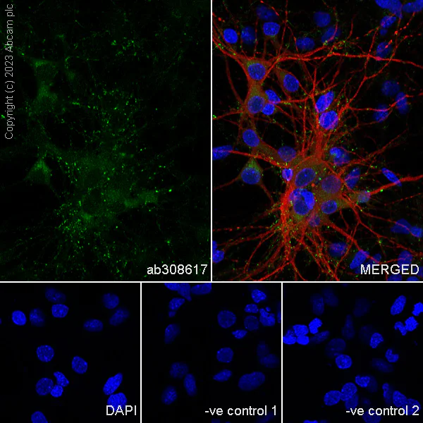 Immunocytochemistry/ Immunofluorescence - Anti-Synaptogyrin 1 antibody [EPR25081-18] (AB308617)