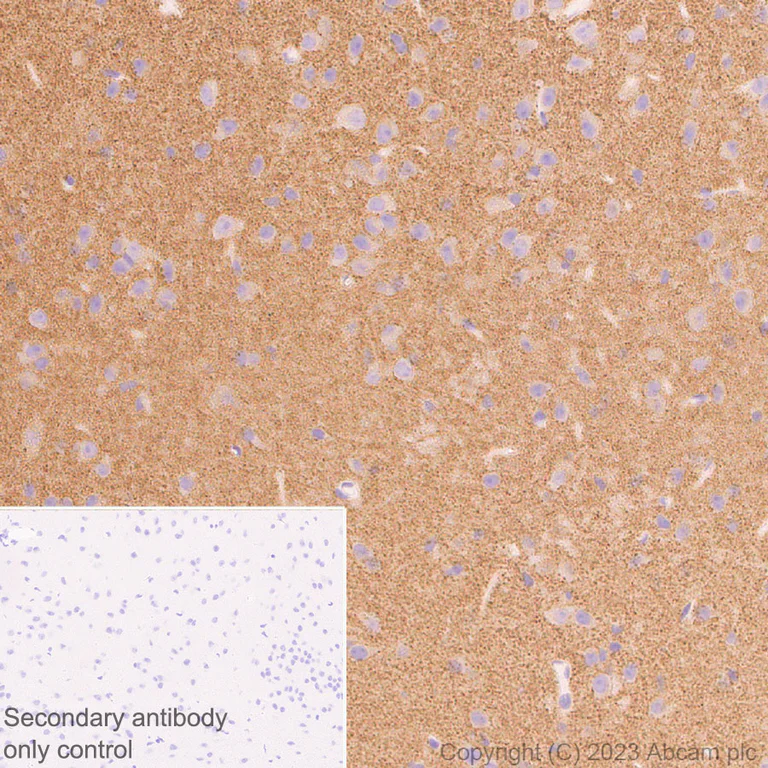 Immunohistochemistry (Formalin/PFA-fixed paraffin-embedded sections) - Anti-Synaptogyrin 1 antibody [EPR25081-18] (AB308617)