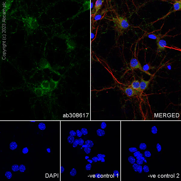 Immunocytochemistry/ Immunofluorescence - Anti-Synaptogyrin 1 antibody [EPR25081-18] - BSA and Azide free (AB308618)