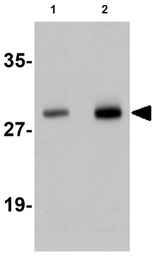 Western blot - Anti-Synaptogyrin 2 antibody (AB106459)