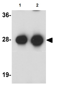 Western blot - Anti-Synaptogyrin 3 antibody (AB106460)