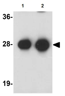 Western blot - Anti-Synaptogyrin 3 antibody (AB106460)
