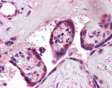Immunohistochemistry (Formalin/PFA-fixed paraffin-embedded sections) - Anti-Synaptogyrin 3 antibody (AB113712)