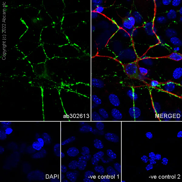 Immunocytochemistry/ Immunofluorescence - Anti-Synaptogyrin 3 antibody [EPR25082-15] - BSA and Azide free (AB302614)