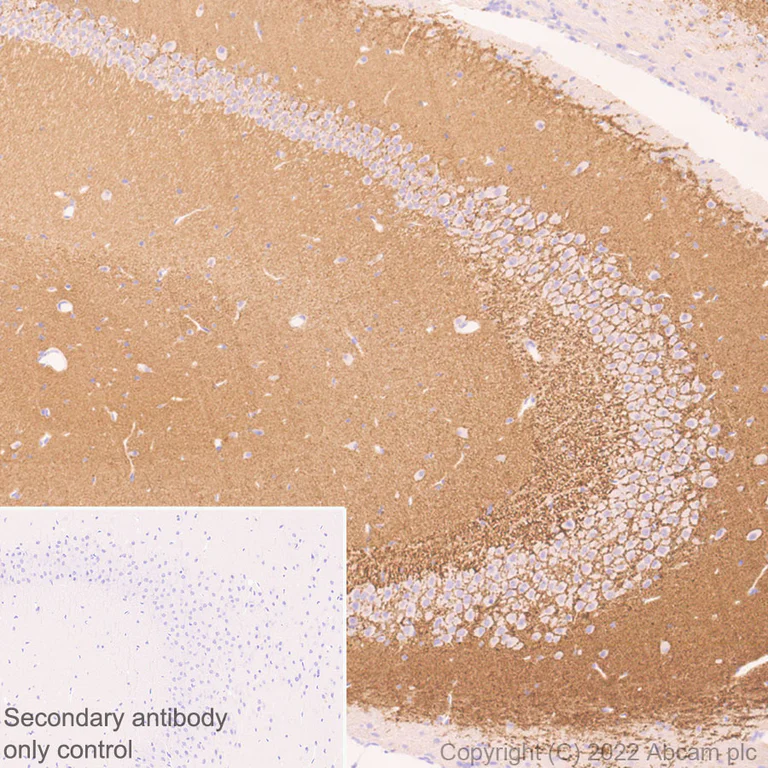 Immunohistochemistry (Formalin/PFA-fixed paraffin-embedded sections) - Anti-Synaptogyrin 3 antibody [EPR25082-15] - BSA and Azide free (AB302614)