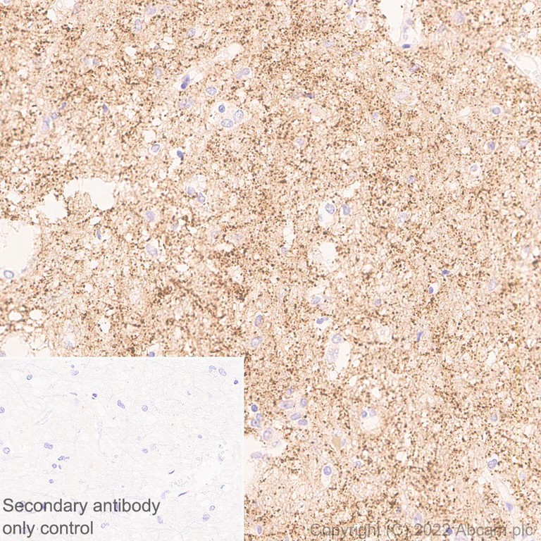 Immunohistochemistry (Formalin/PFA-fixed paraffin-embedded sections) - Anti-Synaptogyrin 3 antibody [EPR25082-29] (AB302704)