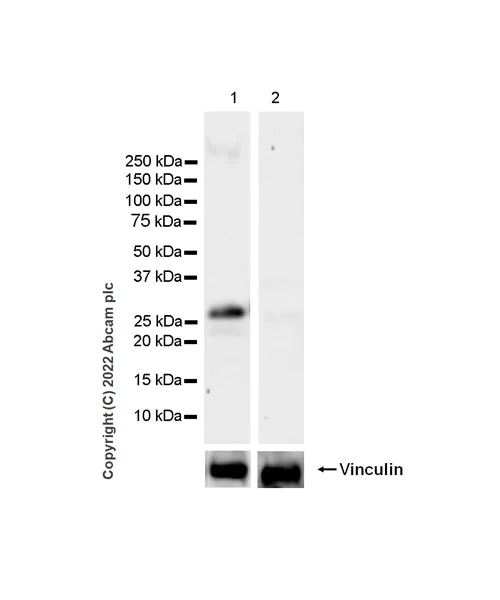 Western blot - Anti-Synaptogyrin 3 antibody [EPR25082-29] (AB302704)