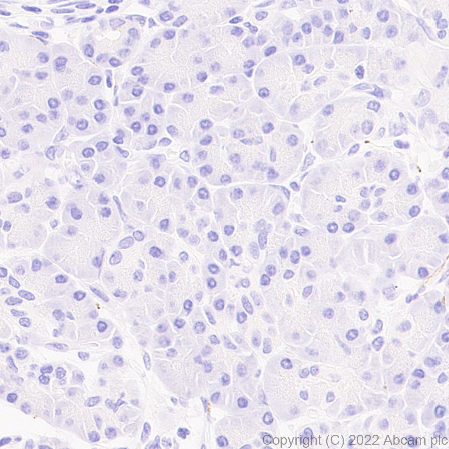 Immunohistochemistry (Formalin/PFA-fixed paraffin-embedded sections) - Anti-Synaptogyrin 3 antibody [EPR25082-29] (BSA and Azide free) (ab302705), expandable thumbnail