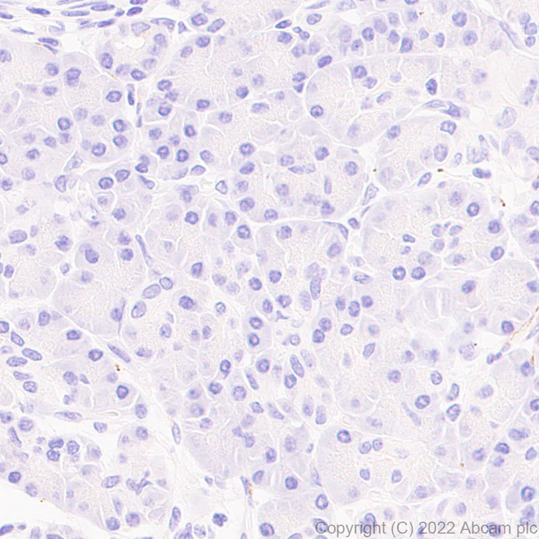 Immunohistochemistry (Formalin/PFA-fixed paraffin-embedded sections) - Anti-Synaptogyrin 3 antibody [EPR25082-29] (BSA and Azide free) (AB302705)