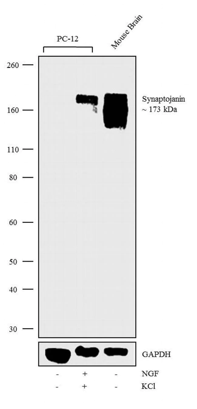 Western blot - Anti-Synaptojanin 1 antibody [RP23040243] (AB308136)