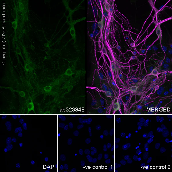 Immunocytochemistry/ Immunofluorescence - Anti-Synaptojanin antibody [EPR28576-183] - BSA and Azide free (AB325802)
