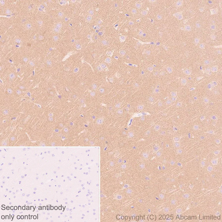 Immunohistochemistry (Formalin/PFA-fixed paraffin-embedded sections) - Anti-Synaptojanin antibody [EPR28576-183] - BSA and Azide free (AB325802)