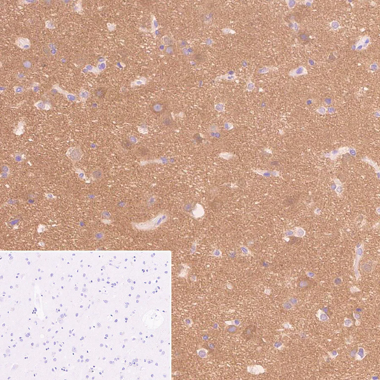 Immunohistochemistry (Formalin/PFA-fixed paraffin-embedded sections) - Anti-Synaptojanin antibody [EPR28576-183] - BSA and Azide free (AB325802)