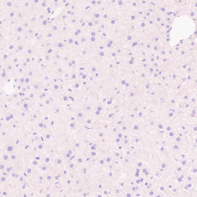 Immunohistochemistry (Formalin/PFA-fixed paraffin-embedded sections) - Anti-Synaptojanin antibody [EPR28576-183] - BSA and Azide free (AB325802)
