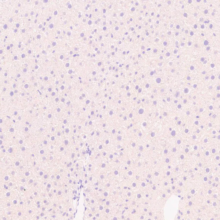 Immunohistochemistry (Formalin/PFA-fixed paraffin-embedded sections) - Anti-Synaptojanin antibody [EPR28576-183] - BSA and Azide free (AB325802)
