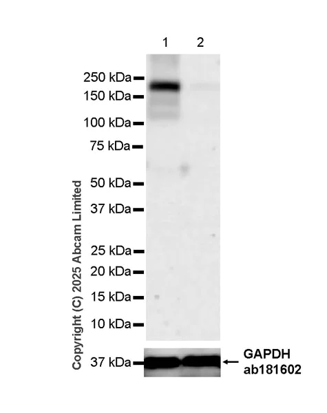 Western blot - Anti-Synaptojanin antibody [EPR28576-183] - BSA and Azide free (AB325802)