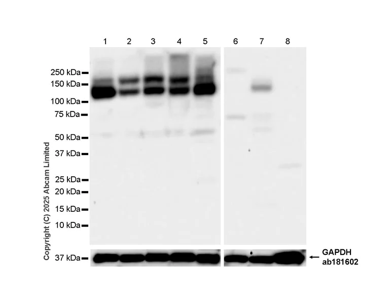 Western blot - Anti-Synaptojanin antibody [EPR28576-183] - BSA and Azide free (AB325802)