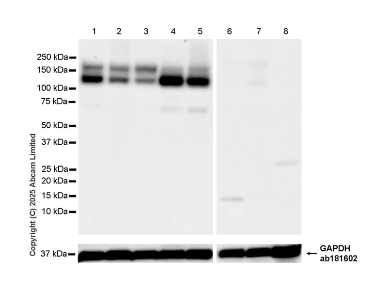 Western blot - Anti-Synaptojanin antibody [EPR28576-183] - BSA and Azide free (AB325802)