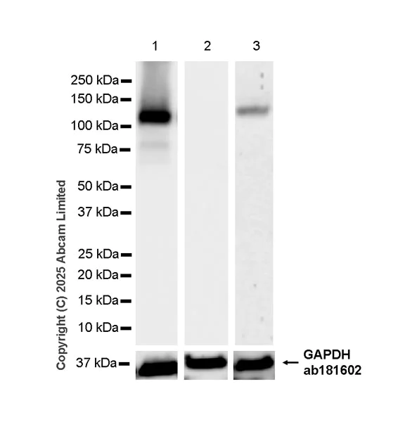 Western blot - Anti-Synaptojanin antibody [EPR28576-183] - BSA and Azide free (AB325802)