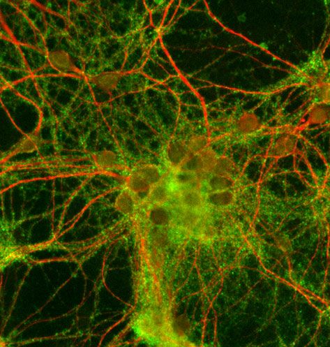 Immunocytochemistry/ Immunofluorescence - Anti-Synaptophysin antibody (AB32594), expandable thumbnail