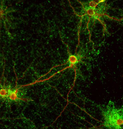 Immunocytochemistry/ Immunofluorescence - Anti-Synaptophysin antibody (ab32594), expandable thumbnail