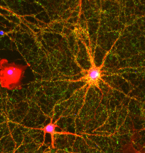 Immunocytochemistry/ Immunofluorescence - Anti-Synaptophysin antibody (AB32594), expandable thumbnail