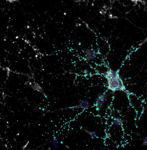Immunocytochemistry/ Immunofluorescence - Anti-Synaptophysin antibody (ab32594), expandable thumbnail