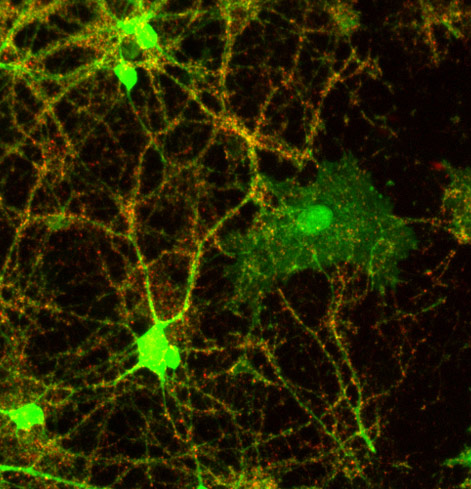 Immunocytochemistry/ Immunofluorescence - Anti-Synaptophysin antibody (ab32594), expandable thumbnail