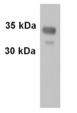 Western blot - Anti-Synaptophysin antibody (ab32594), expandable thumbnail