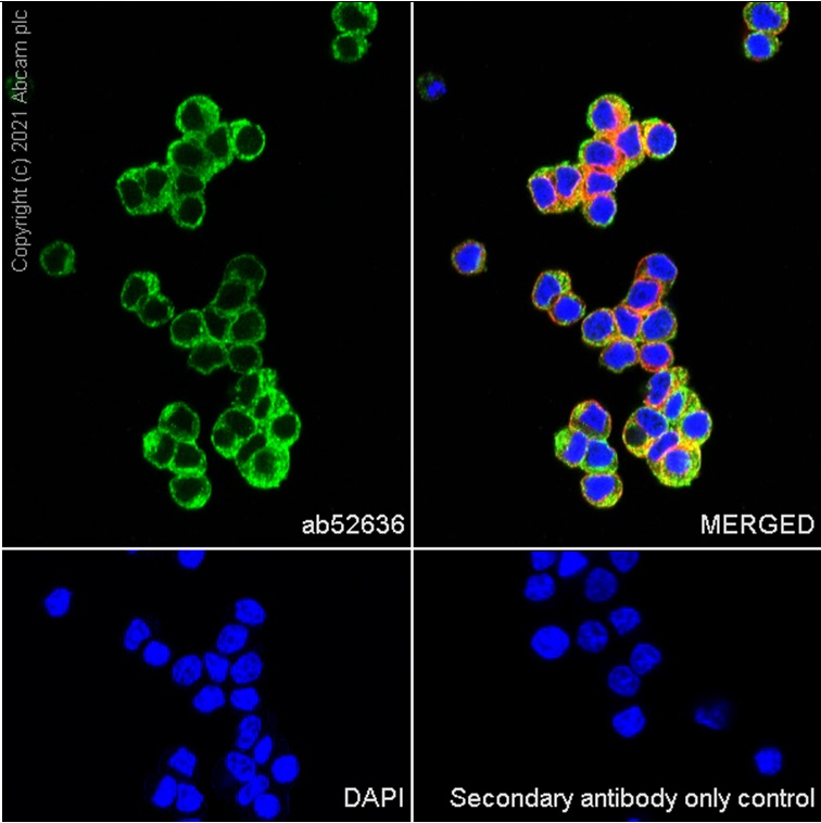 Immunocytochemistry/ Immunofluorescence - Anti-Synaptophysin antibody [EP1098Y] (AB52636), expandable thumbnail