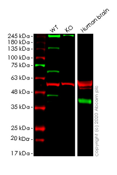Western blot - Anti-Synaptophysin antibody [EP1098Y] - Synaptic Marker (AB52636), expandable thumbnail