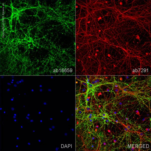 Immunocytochemistry - Anti-Synaptophysin antibody [SP11] - Synaptic Marker (AB16659)