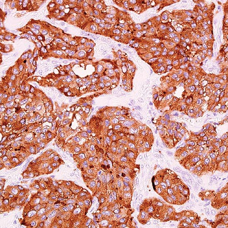 Immunohistochemistry (Formalin/PFA-fixed paraffin-embedded sections) - Anti-Synaptophysin antibody [SP11] (AB16659), expandable thumbnail