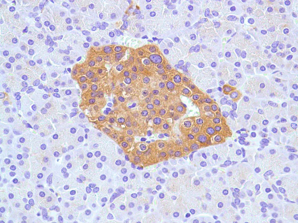 Immunohistochemistry (Formalin/PFA-fixed paraffin-embedded sections) - Anti-Synaptophysin antibody [SP11] - Synaptic Marker (AB16659)