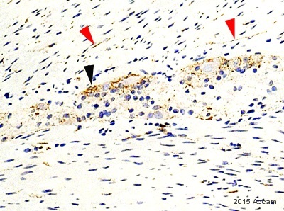 Immunohistochemistry (Formalin/PFA-fixed paraffin-embedded sections) - Anti-Synaptophysin antibody [SY38] (AB8049), expandable thumbnail