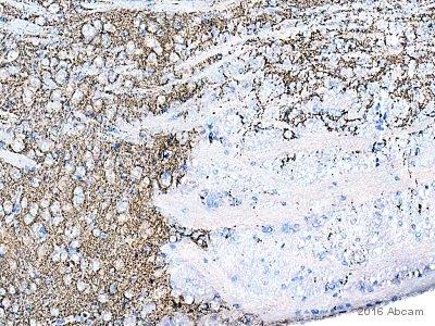 Immunohistochemistry (Formalin/PFA-fixed paraffin-embedded sections) - Anti-Synaptophysin antibody [SY38] - Synaptic Marker (AB8049), expandable thumbnail