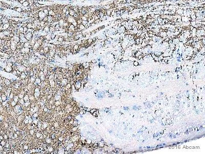 Immunohistochemistry (Formalin/PFA-fixed paraffin-embedded sections) - Anti-Synaptophysin antibody [SY38] - Synaptic Marker (AB8049)