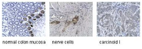 Immunohistochemistry (Formalin/PFA-fixed paraffin-embedded sections) - Anti-Synaptophysin antibody [SY38] - Synaptic Marker (AB8049)