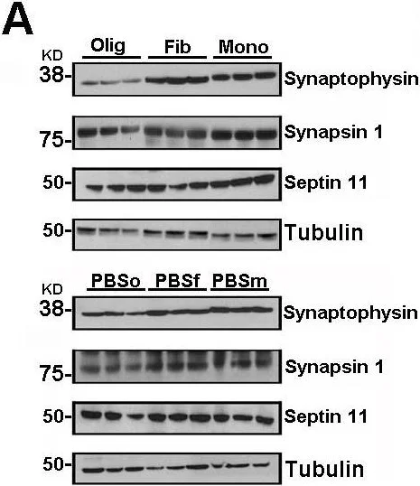 Western blot - Anti-Synaptophysin antibody [SY38] - Synaptic Marker (AB8049)